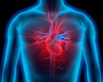 Grafik Herzkatheter